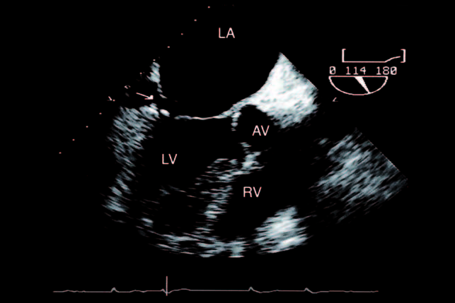 Echocardia Wiki